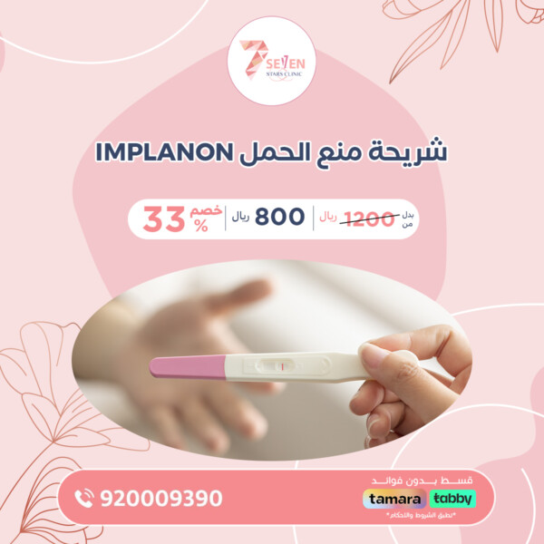 شريحة منع الحمل Implanon